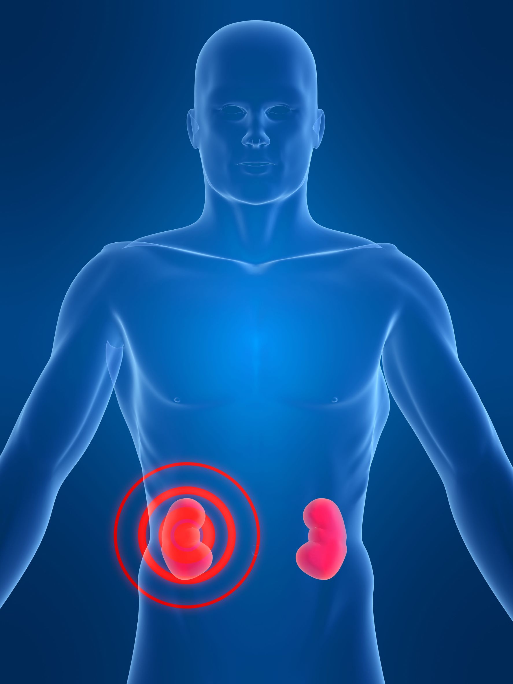 Diabetic Kidney Disease Studies