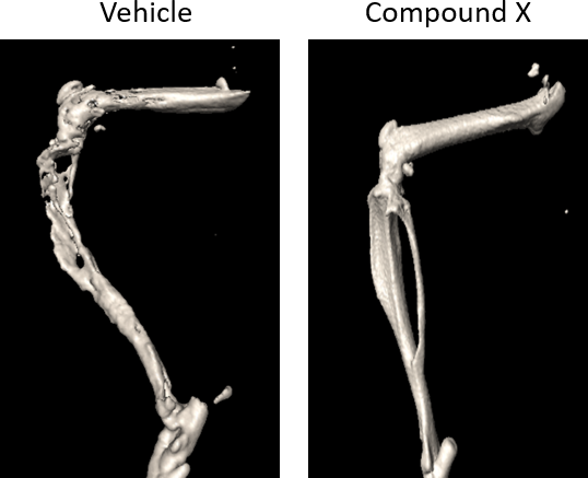 图2B：骨CT成像。