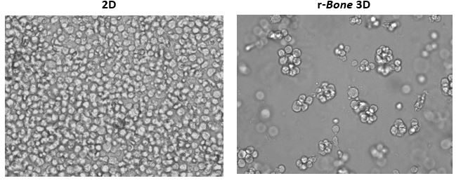 图1:U266B1人骨髓瘤细胞的2D与重建骨（r-骨）3D培养