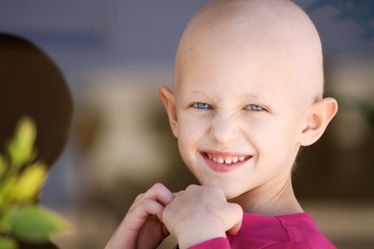 快乐的孩子与 - 脱发 - 因为-的化疗