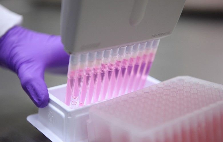 Validierung des CLL-ERIC-MRD-Durchflusszytometrie-Panels in einem CAP-/CLIA-konformen Modell