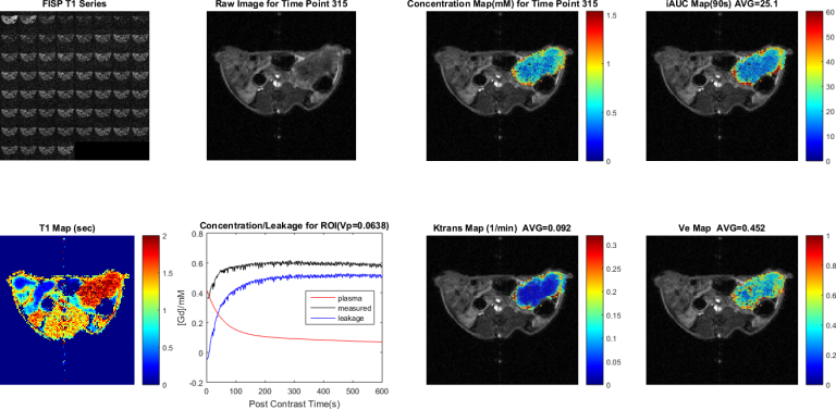 Analyze DerTumorpermeabilitätUntervendung von Redcat™Fürdce-mrt-mrt-Analyze