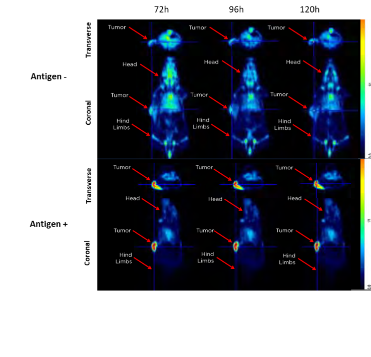 图1.注射89zr标记抗原后使用PET的Ag +和Ag-Tumors的代表性图像。显示横向和冠状平面。