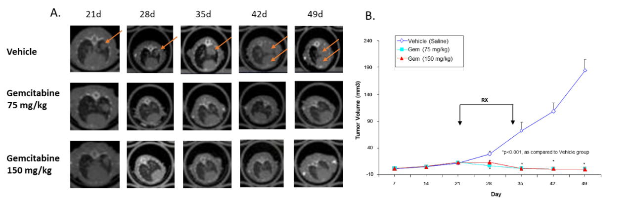 图4：吉西他滨对人非小细胞肺腺癌H441的影响将OT注入裸鼠。A.代表性的纵向图像。B.肿瘤量的定量。